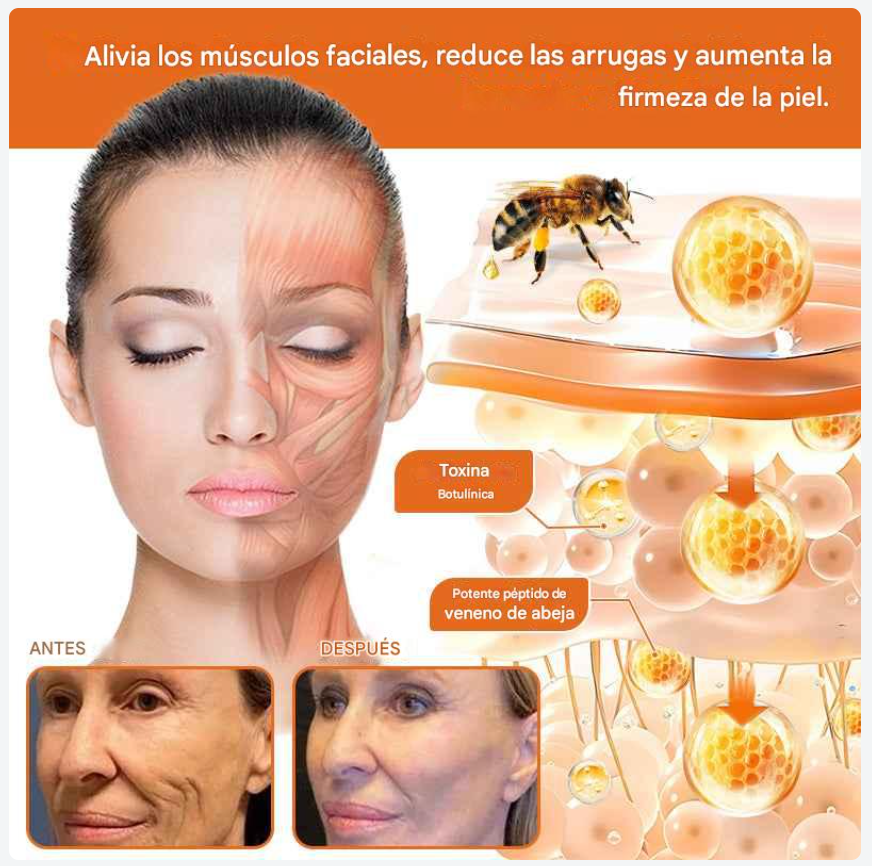 BOTOX BEE SIN CIRUGIA